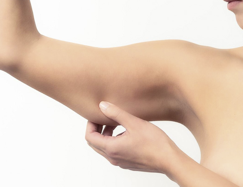 arm