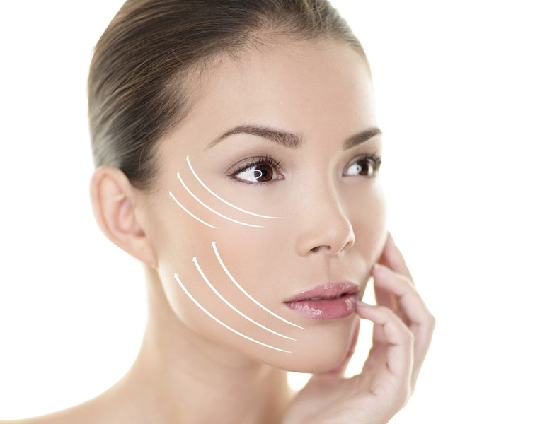 face lift