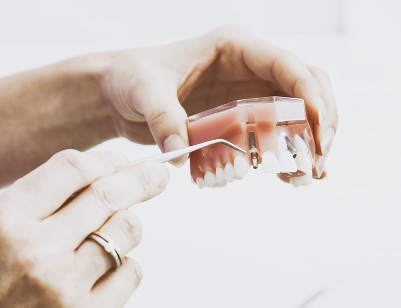 implant