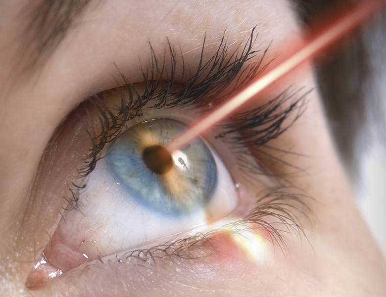 laye eye