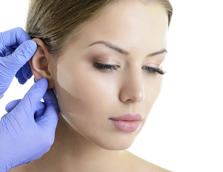 otoplasty ear